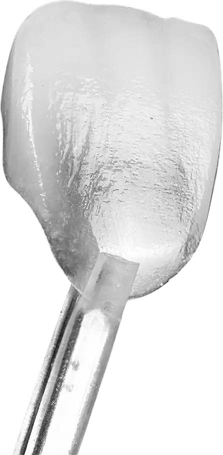 Faccette Dentali - Elite